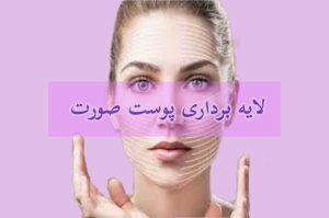 لایه <yoastmark class=