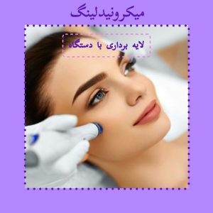 میکرولیندینگ