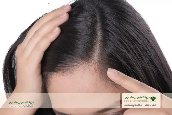 مشکلات رایج مو
