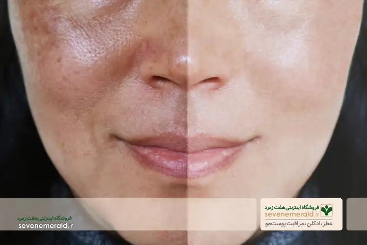 روشن کننده پوست چه تاثیری در صورت دارد